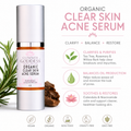 Organic Acne Serum – Oil Control & Pore Clearing Treatment-5